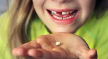 What You Need to Know Before Removing Your Child’s Baby Teeth at Home