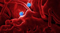 Leptospirosis