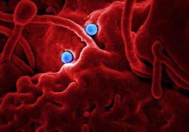 Leptospirosis