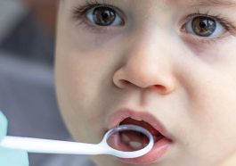 Early Childhood Caries