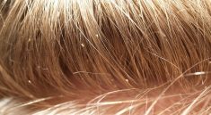 Head Lice in Schools