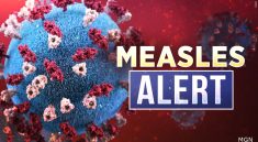Measles Outbreak Alert