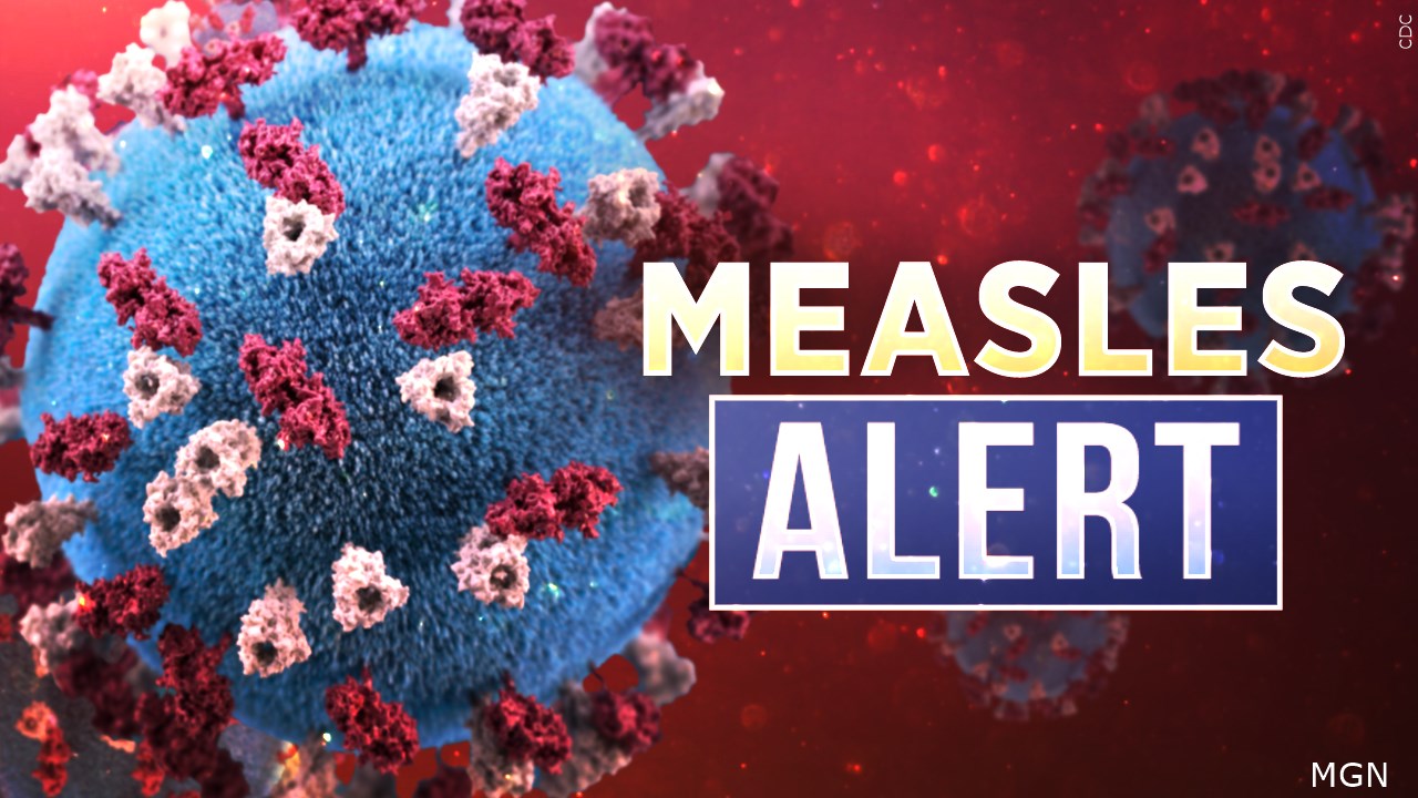 Measles Outbreak Alert