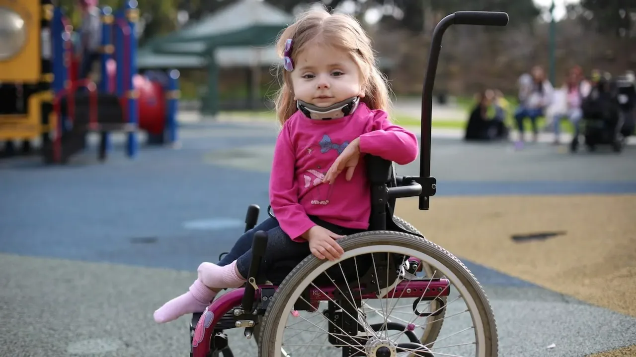 Osteogenesis Imperfecta in Children