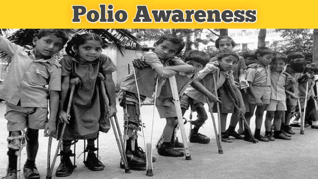 The Spread of Polio in Children