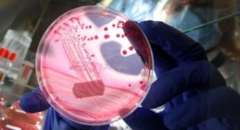E coli Outbreak in Northern France Claims Life of 12-Year-Old Girl