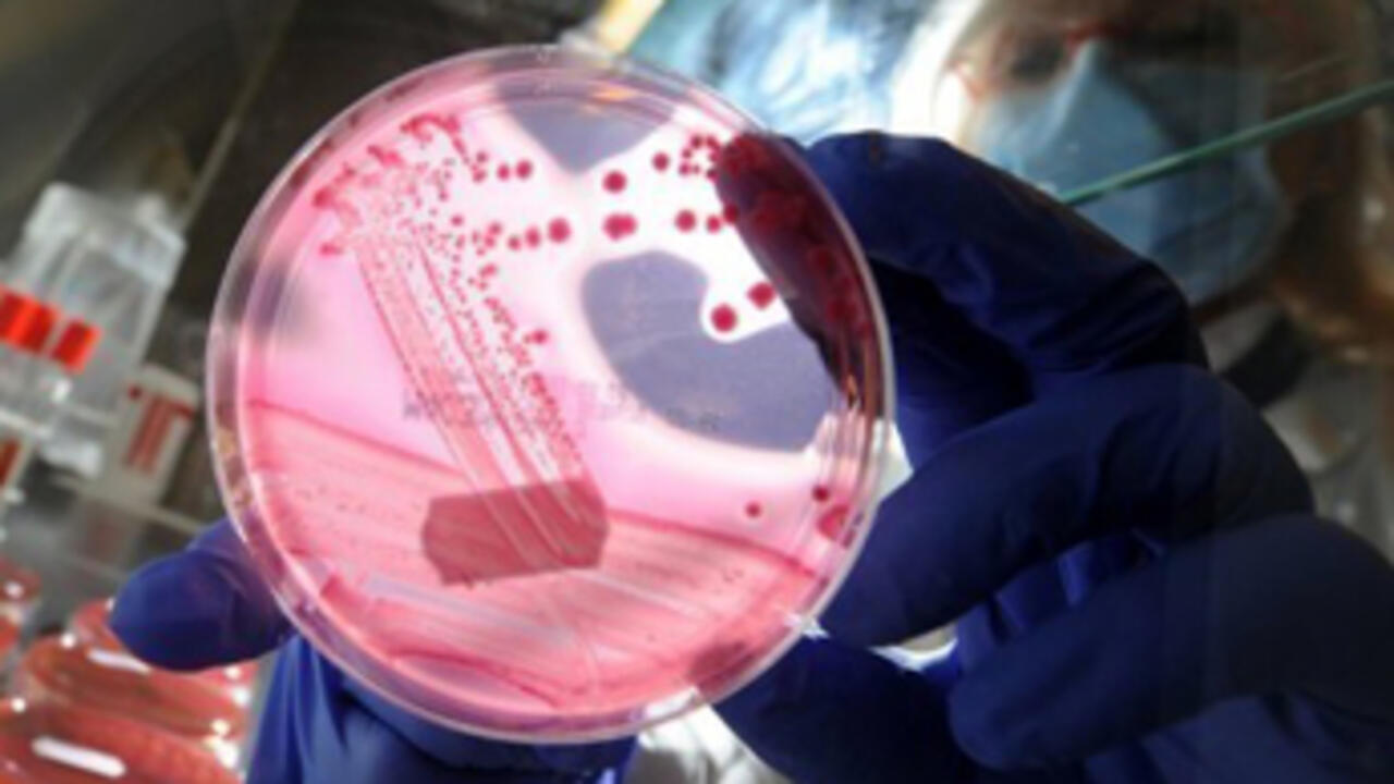 E coli Outbreak in Northern France