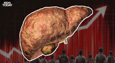 Fatty Liver Disease Surges Among Indian Children