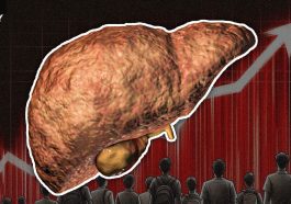 Fatty Liver Disease Surges Among Indian Children