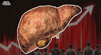 Fatty Liver Disease Surges Among Indian Children: Doctors Raise Red Flags