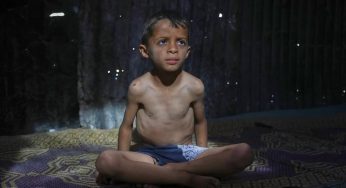 Gaza’s Silent Emergency: Malnutrition Crisis Hits Thousands of Children