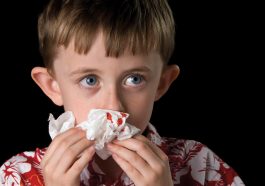 Kids Experience Frequent Nosebleeds
