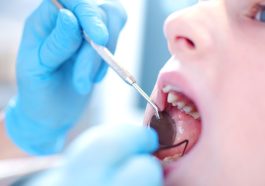 Tooth Erosion in Children