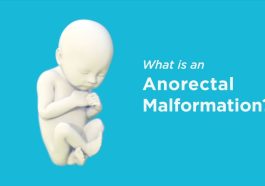 Anorectal Malformation