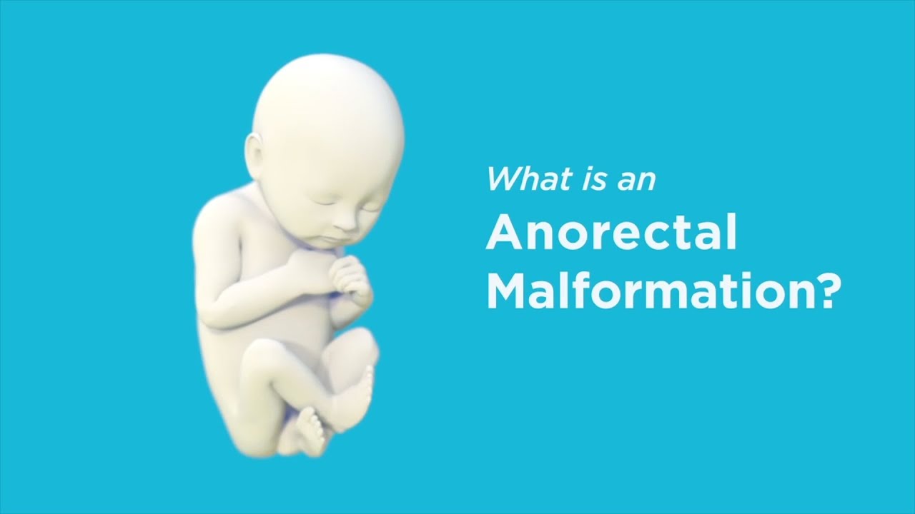 Anorectal Malformation