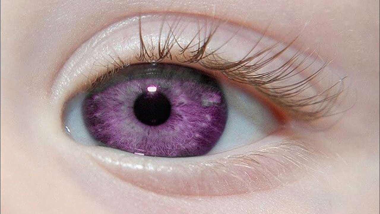 Rare Eye Colors in Children