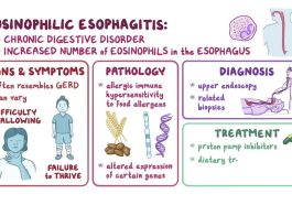Eosinophilic Esophagitis