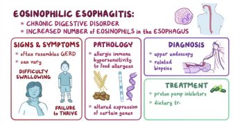 Mystery Illness Making Your Child Avoid Food? It Might Be Eosinophilic Esophagitis!