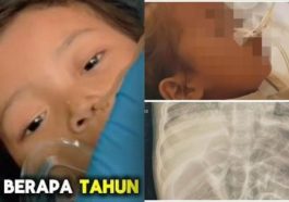 Toddler's Body Overrun by Worms