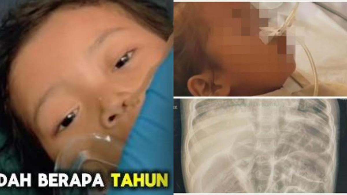 Toddler's Body Overrun by Worms