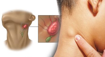 How to Spot and Fight Lymph Node Disease in Your Child Before It’s Too Late