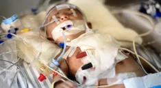 Pediatric Cardiomyopathy