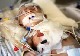 Pediatric Cardiomyopathy