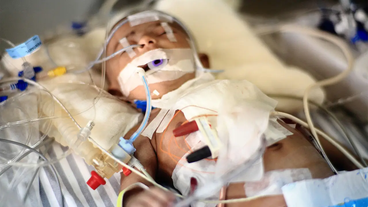 Pediatric Cardiomyopathy