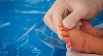 Extra Fingers on Kids? Discover the Untold Story of Polydactyly!