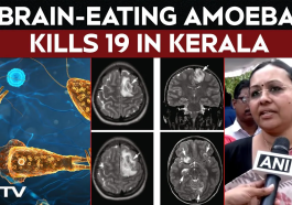 Brain-Eating Amoeba